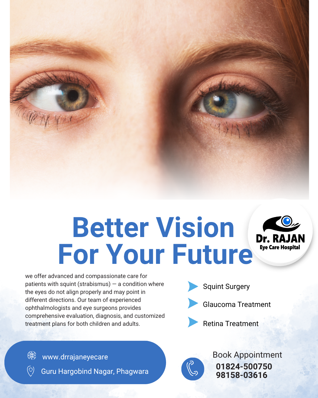 भेंगापन का इलाज